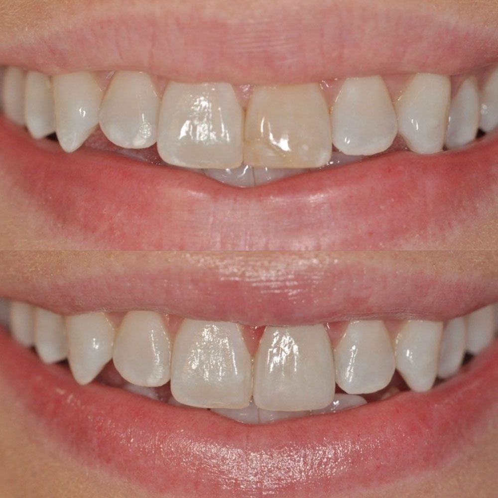 before-and-after-18-woodbridge-comfort-dental-care