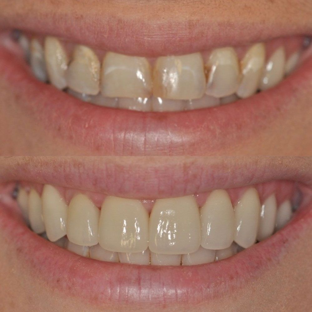 before-and-after-19-woodbridge-comfort-dental-care
