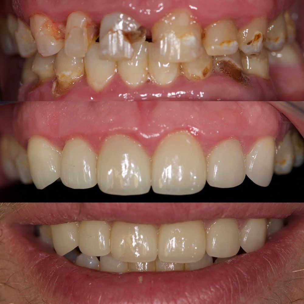 before-and-after-20-woodbridge-comfort-dental-care