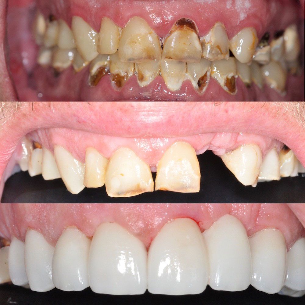 before-and-after-22-woodbridge-comfort-dental-care