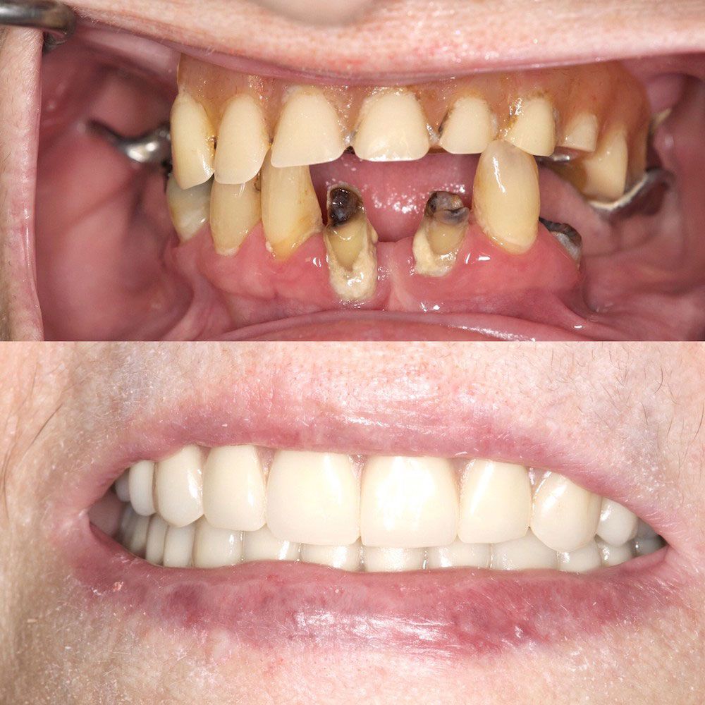 before-and-after-23-woodbridge-comfort-dental-care
