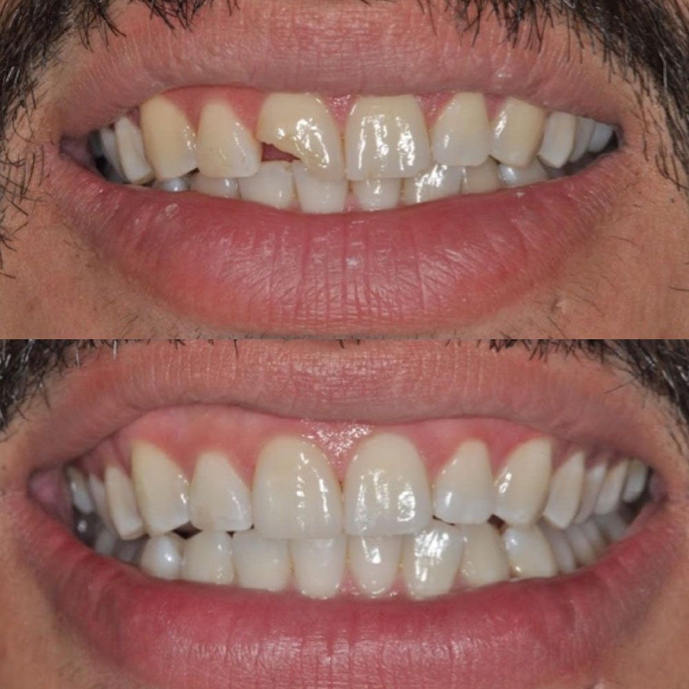 before-and-after-25-woodbridge-comfort-dental-care