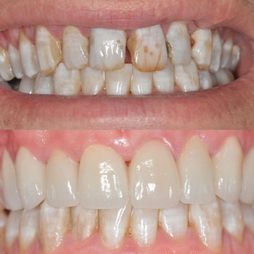 before-and-after-26-woodbridge-comfort-dental-care