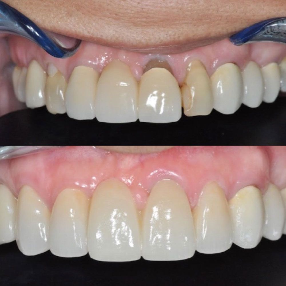 before-and-after-27-woodbridge-comfort-dental-care