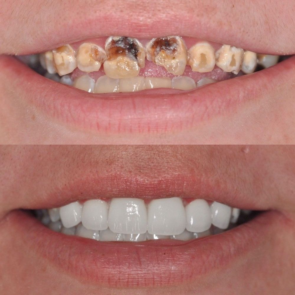 before-and-after-29-woodbridge-comfort-dental-care