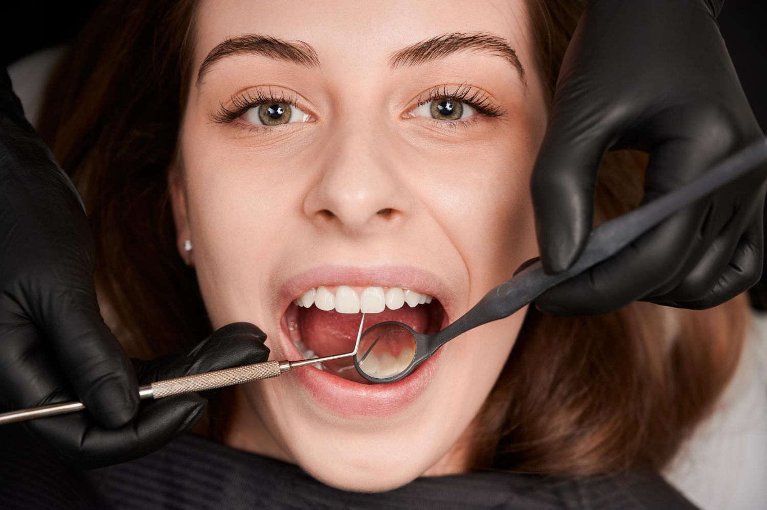 How to Fix a Chipped Tooth: Repair Options by Chip Size